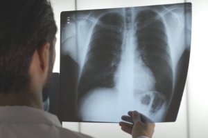 Faltas nos exames e consultas gera desperdícios e demora no atendimento