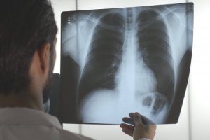 Saúde: Como procurar atendimento no local certo