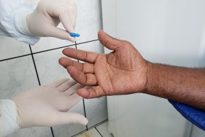 Hansen&iacute;ase - Aproveite o �Janeiro Roxo� para conhecer, identificar e tratar essa doen&ccedil;a contagiosa