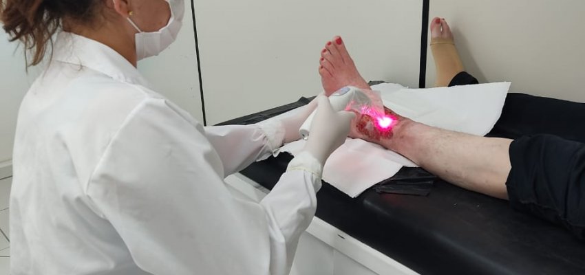 Ambulat&oacute;rio de les&otilde;es de pele tem 300 altas num ano