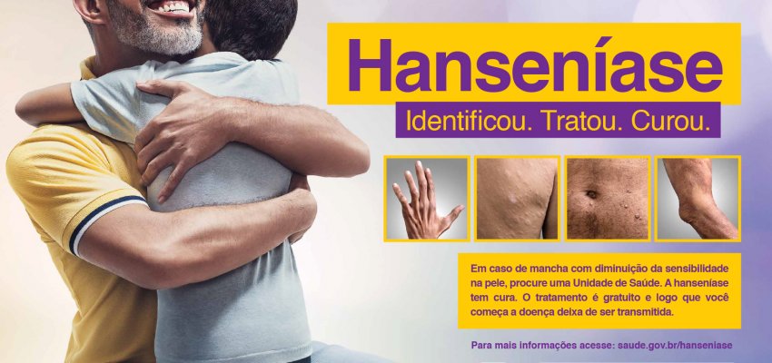 Janeiro Roxo: Mês para campanhas educativas sobre a hanseníase
