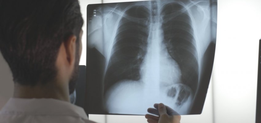 Sa&uacute;de: A&ccedil;&otilde;es do Novembro Azul acontecem no s&aacute;bado (24) em Chapec&oacute;