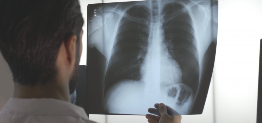 Sa&uacute;de: Como procurar atendimento no local certo